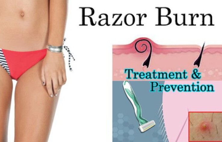 Reduce bikini razor bumps