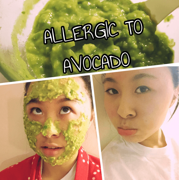 10 Home Remedies to Get Rid of Avocado Allergy Fast