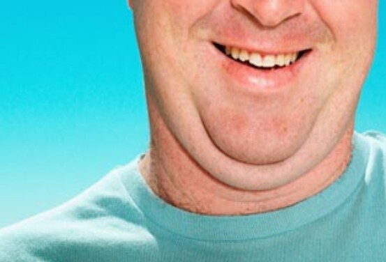 Get Rid Of Neck Fat 118