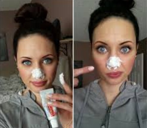 Toothpaste to get rid of Blackheads