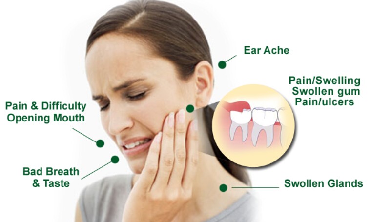15 Natural Home Remedies For Wisdom Teeth Pain