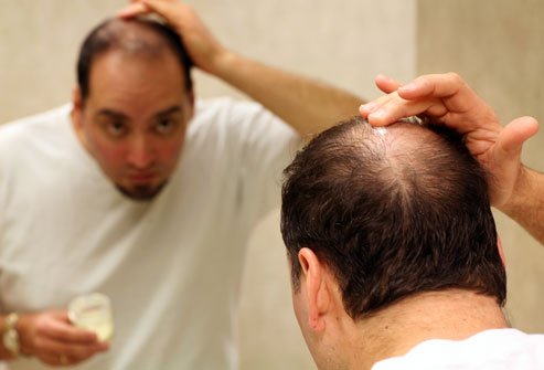 Home Remedies For Baldness and Hair Loss