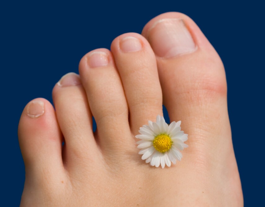 how-to-get-rid-of-ingrown-toenails-and-fingernails