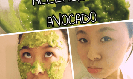 Get Rid of Avocado Allergies