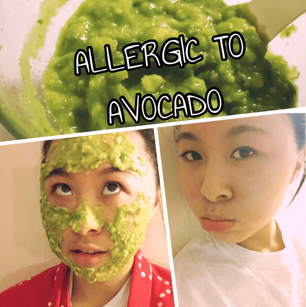 Get Rid of Avocado Allergies