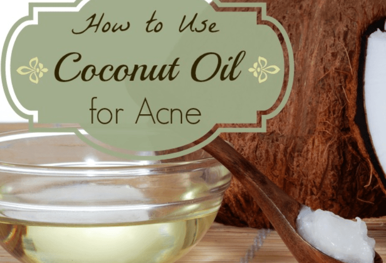 How to Use Coconut Oil for Acne Treatment