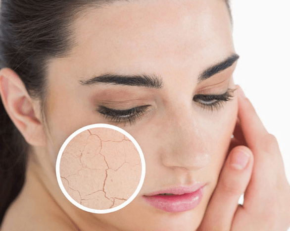 How To Remove Dry Skin From Face Naturally At Home