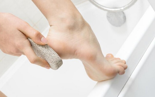 10 Home Remedies to Get Rid of Corns and Calluses Fast
