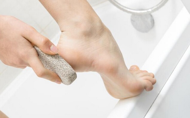 14-home-remedies-to-get-rid-of-corns-and-calluses