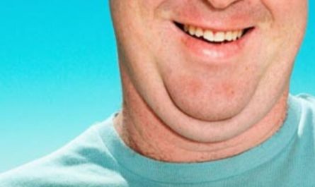 get rid of neck fat