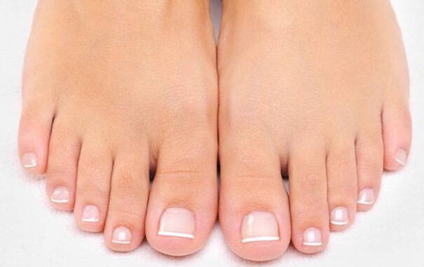 16 Natural Remedies to Get Rid of Toe Fungus
