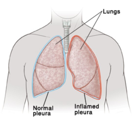 Lungs Behind Ribs / Parts of human skeleton.pdf / Bagian-bagian Rangka Manusia