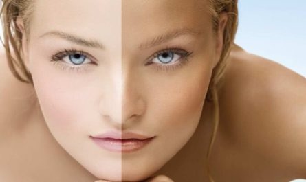 Home Remedies to Get Lighter Skin
