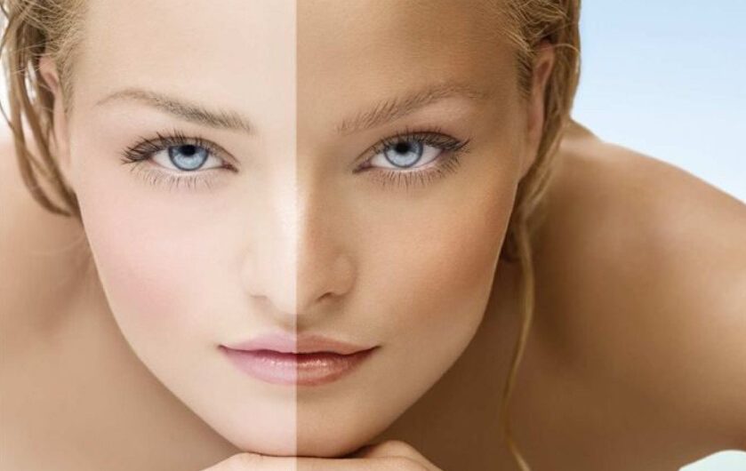 10 Easy Home Remedies to Get Lighter Skin