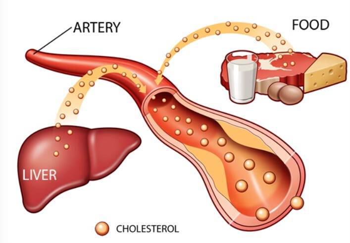 lower cholesterol