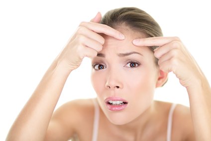 Get Rid of Forehead Acne Fast