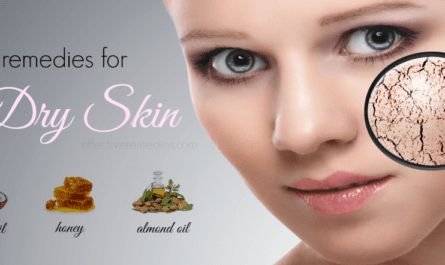 Home Remedies for Dry Patches on Face