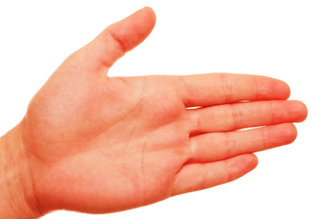 Treatments for Itchy Palms