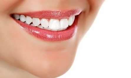 Home Remedies for Teeth Whitening