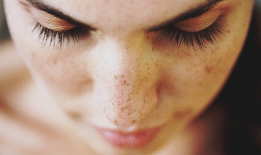 How to Get rid of Dark Spots on Your Face