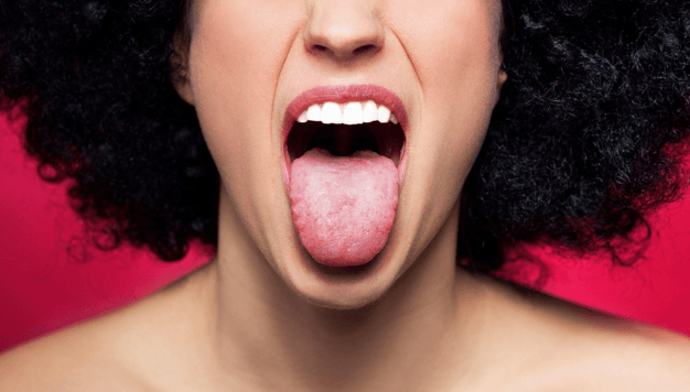 Bumps on Back of Tongue: White, Red, Black or Sore Throat