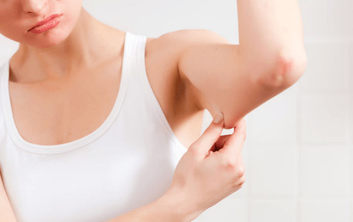 10 Home Remedies to Get Rid of Cellulite on Arms