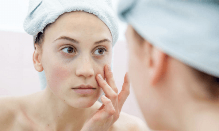 how to get rid of large pores