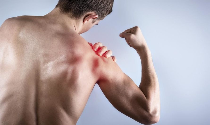 Pain in Shoulder and Arm:12 Causes with Treatment