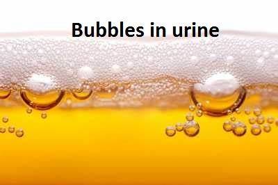 Serious Conditions that Cause Bubbles in Urine