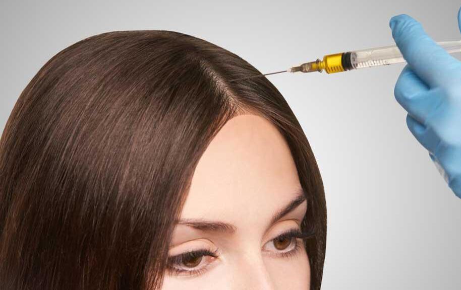 Thinning Hair in Women Treatment