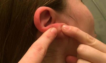 bumps or lumps behind the ear