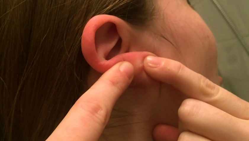 bumps or lumps behind the ear