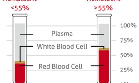 Hematocrit (hct) Blood Test