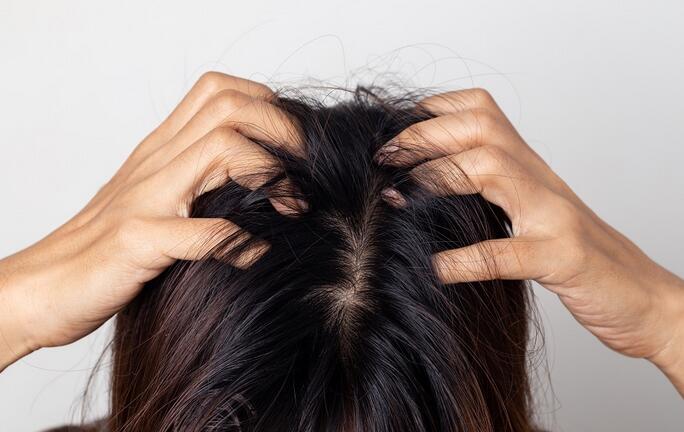 Dry Itchy Scalp: 14 Common Causes with Treatment
