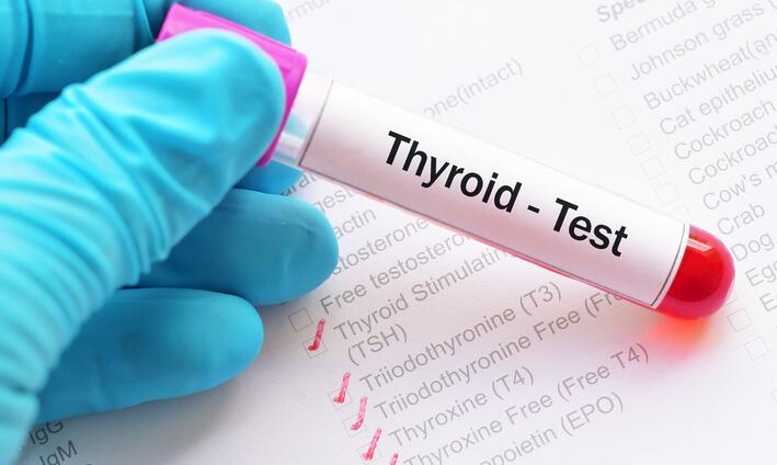 TSH Test: What do Normal, High, and Low Levels Mean?