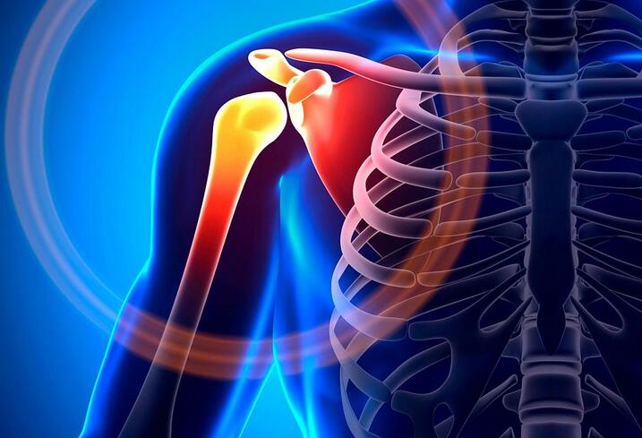 Shoulder Pain Diagnosis Chart: Causes and Treatment