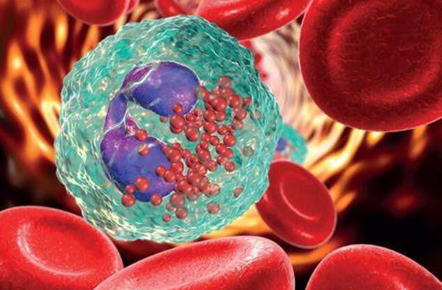 High Eosinophils