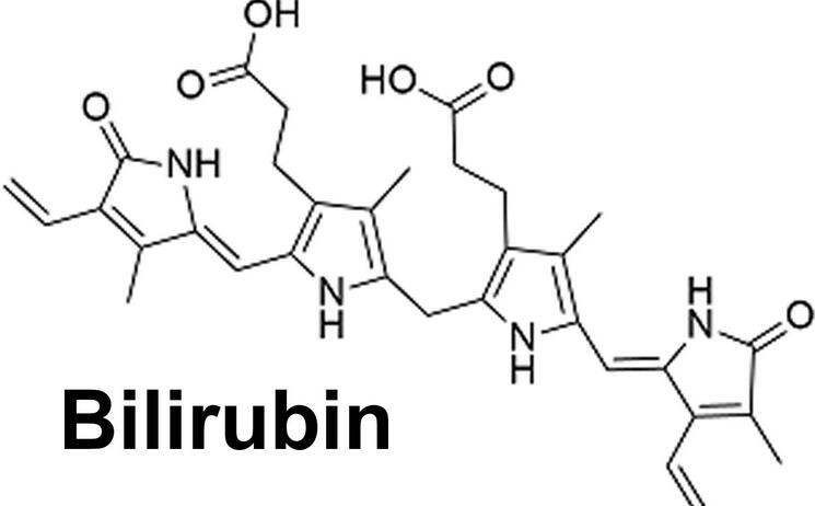 Urine Bilirubin