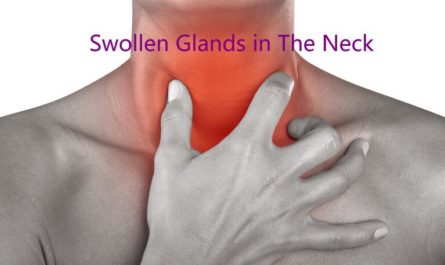 Swollen Glands in The Neck