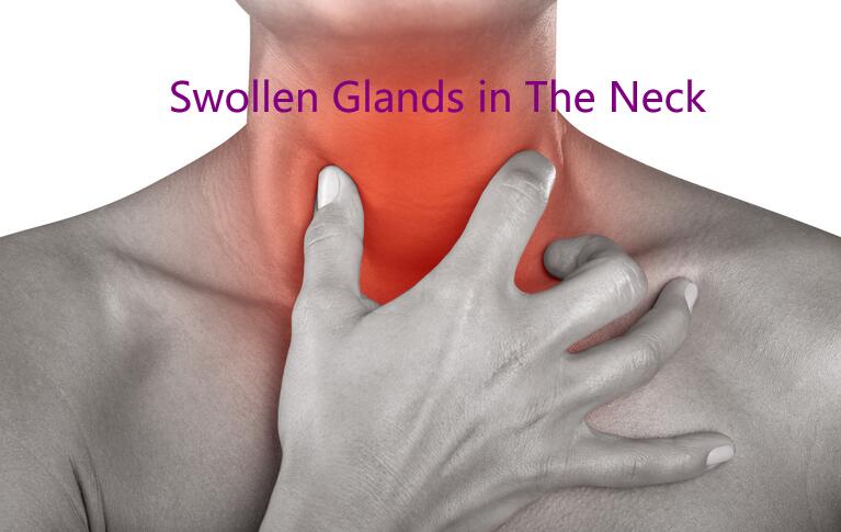 Swollen Glands in The Neck