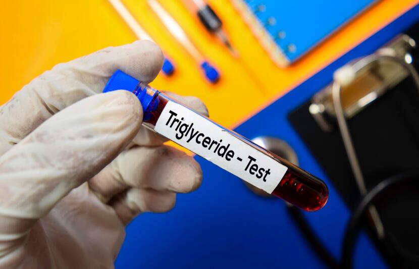 High Triglycerides Treatment