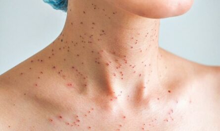 red dots on the skin