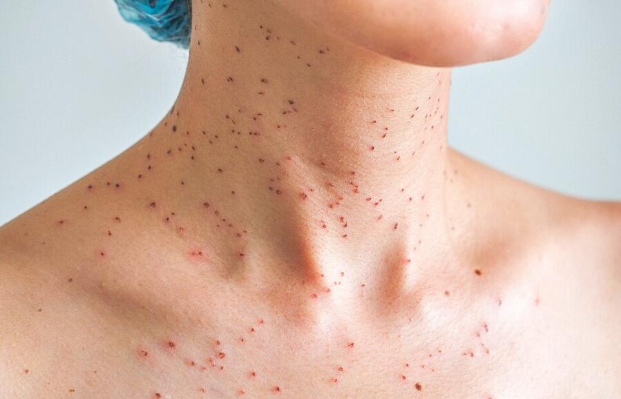 red dots on the skin