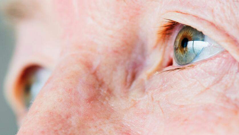 Black Spots in Vision:10 Causes with Treatment