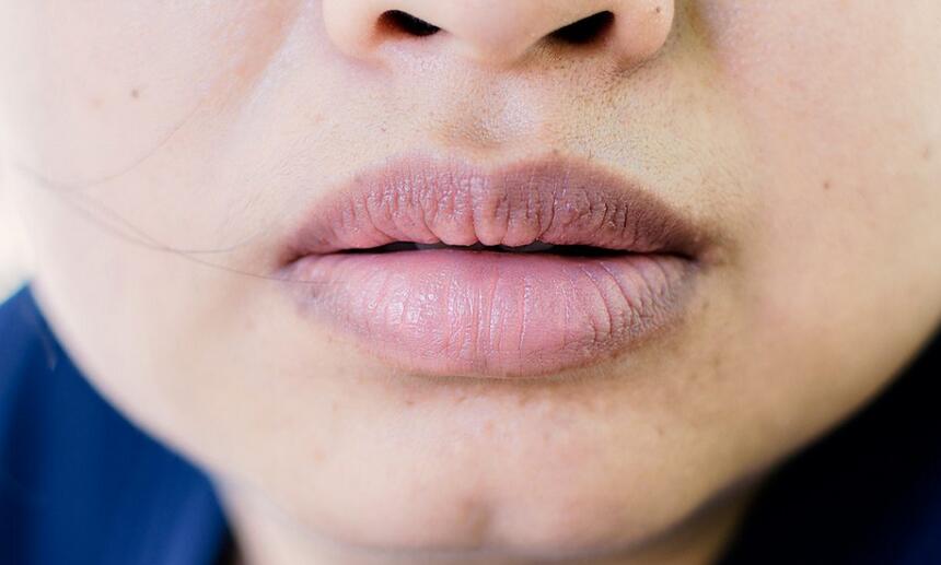 Black Dots on Lip: Causes, Treatment, and Prevention