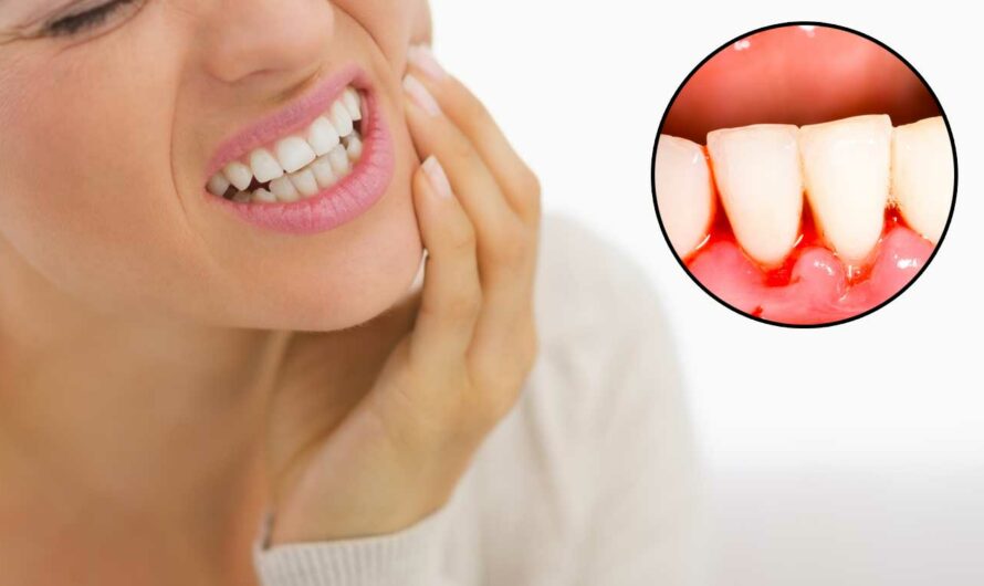 Why Your Gums Bleed and How to Stop It