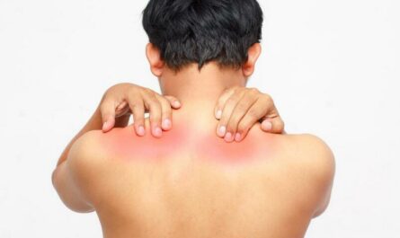 Neck Shoulder and Arm Pain