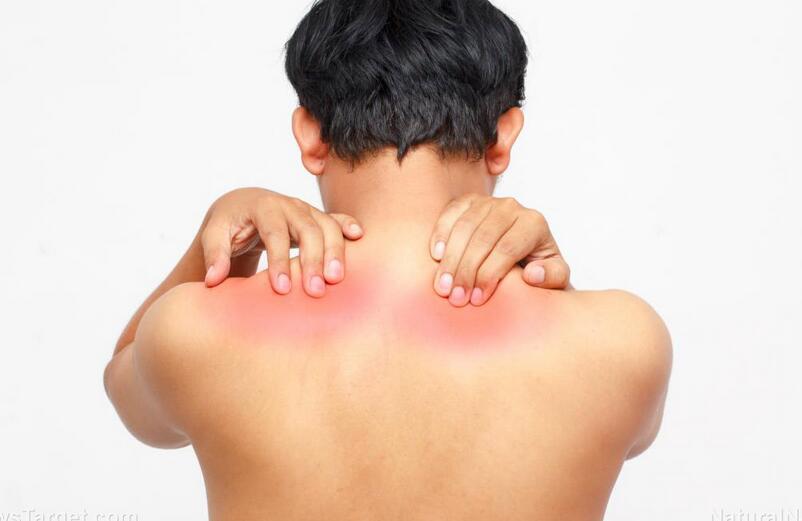 Neck Shoulder and Arm Pain