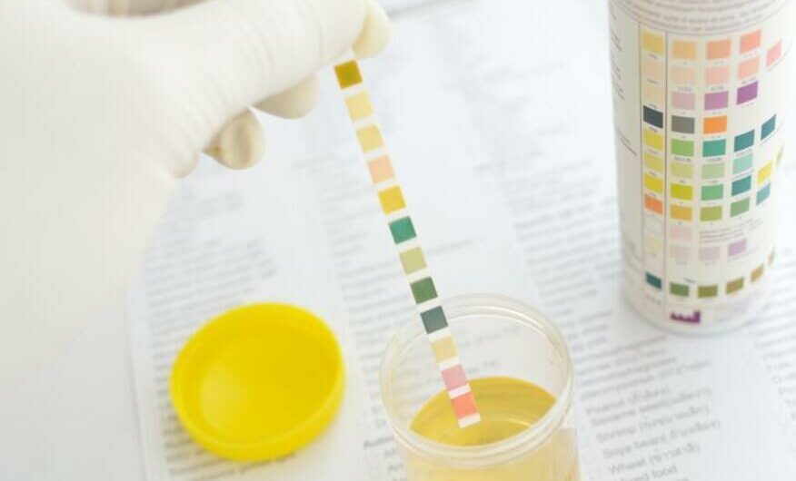 Elevated Leukocyte Esterase in Urine: Causes with Treatment