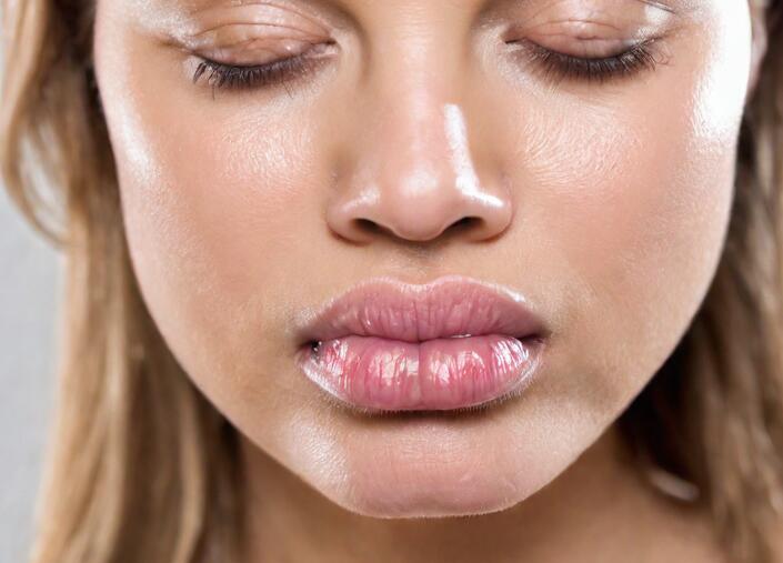 Prevent Swollen Lips